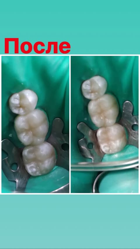 После лечения