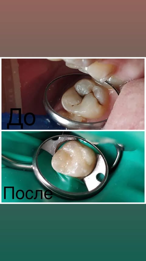 После лечения