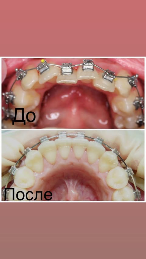 После лечения